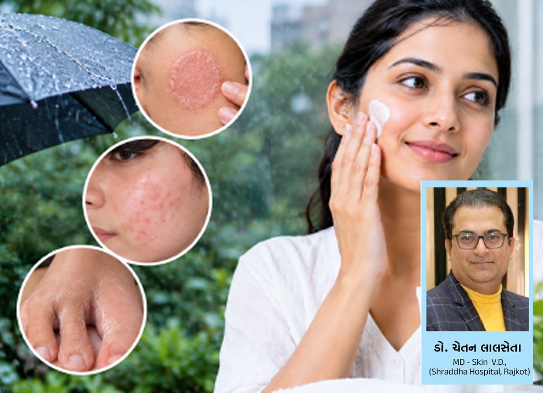 Why is it important to take special care of skincare during the monsoon?